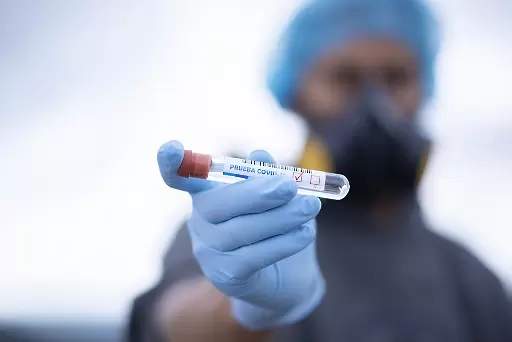 Петима футболисти на Цървена звезда с положителни тестове за коронавирус - Световен футбол