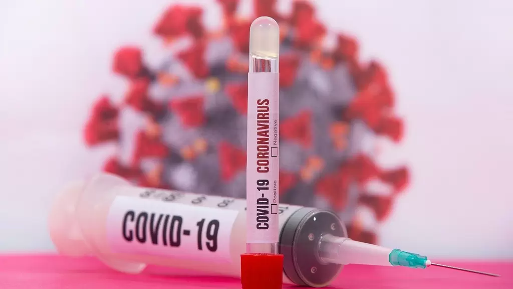 И в Ювентус има заразени от COVID-19 - Италия