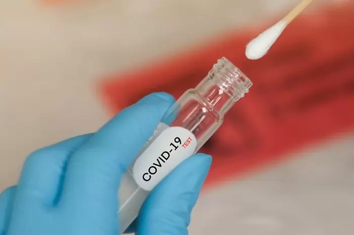 Седми случай на заразен с COVID-19 в Парма - Италия