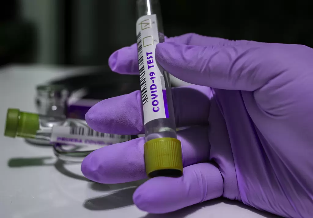 Бивша футболистка вече 331 дни се бори с COVID-19
