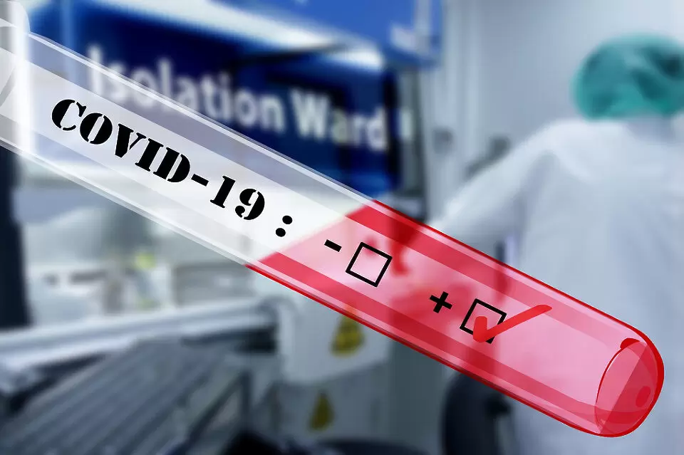 Шалке отмени тренировка заради положителен тест за COVID-19