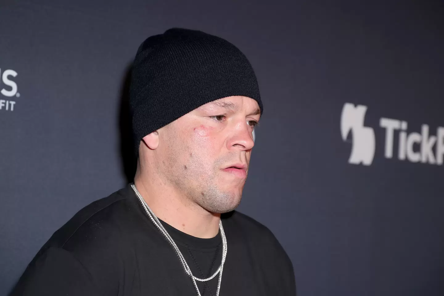 UFC звездата Нейт Диас е в ареста, твърди, че е действал при самоотбрана