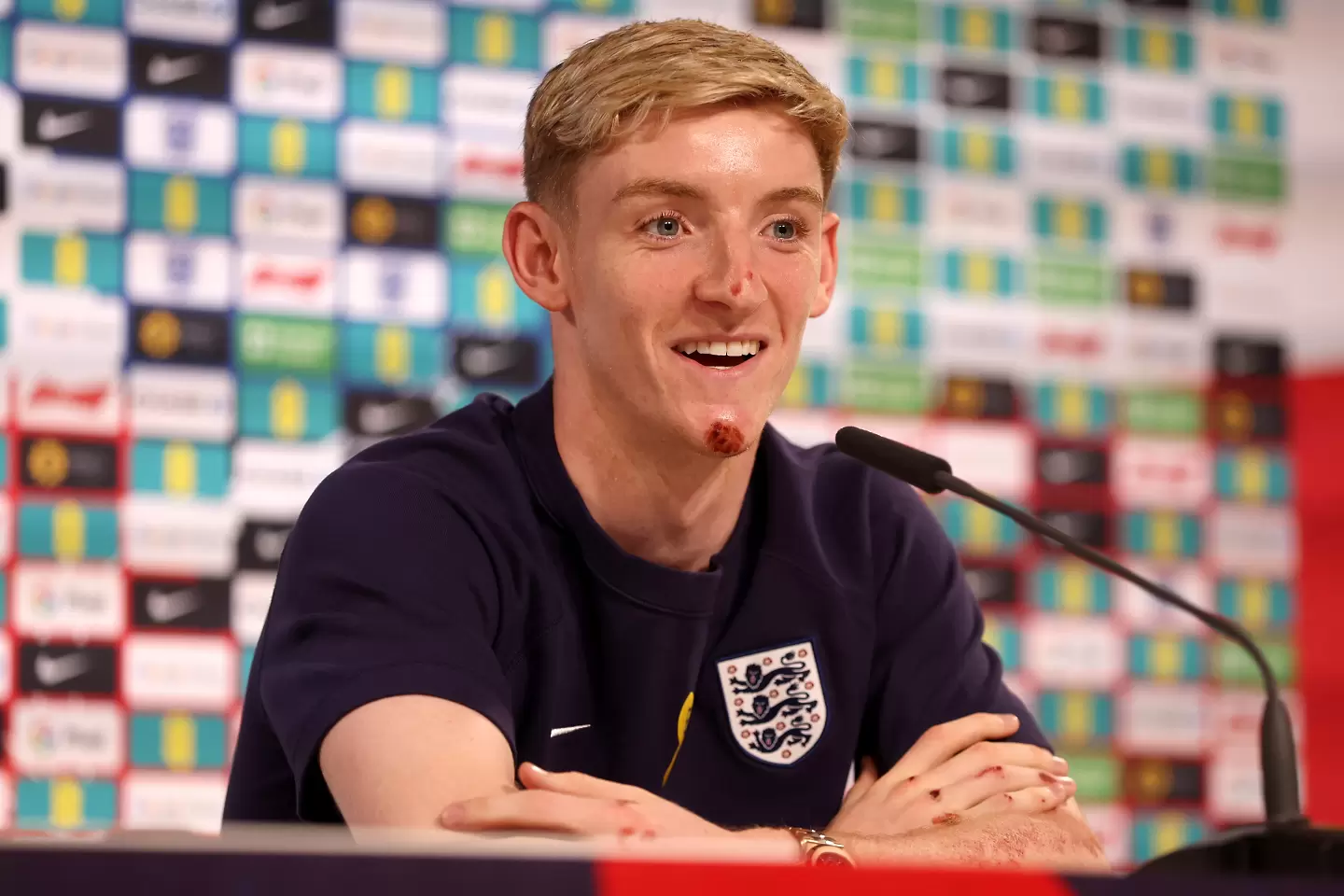 Антъни Гордън / Getty Images